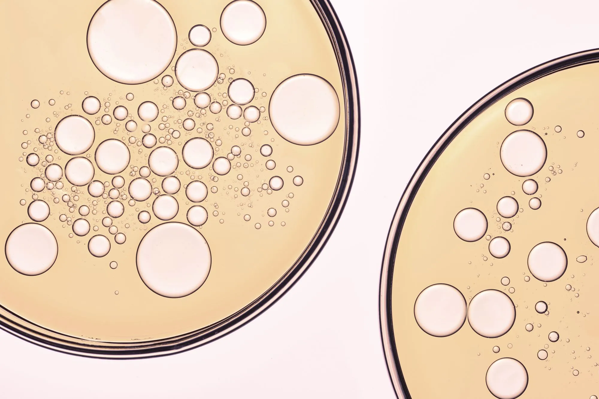 IUI or IVF: Which One Should You Choose?